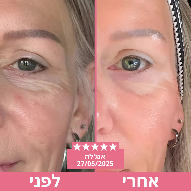 Velvet™ סט טיפוח צוואר ועיניים מהדק ומחדש