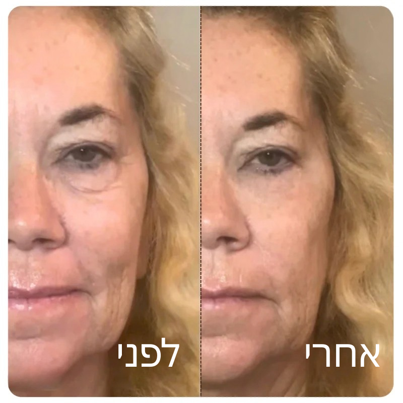 Velvet™ אמפולת קולגן משי קוריאני