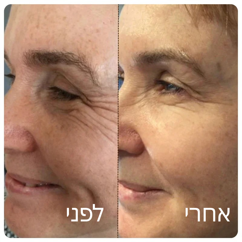 Velvet™ אמפולת קולגן משי קוריאני