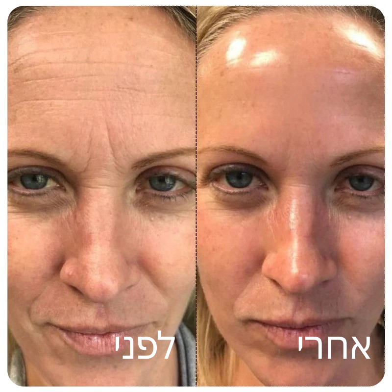 Velvet™ אמפולת קולגן משי קוריאני