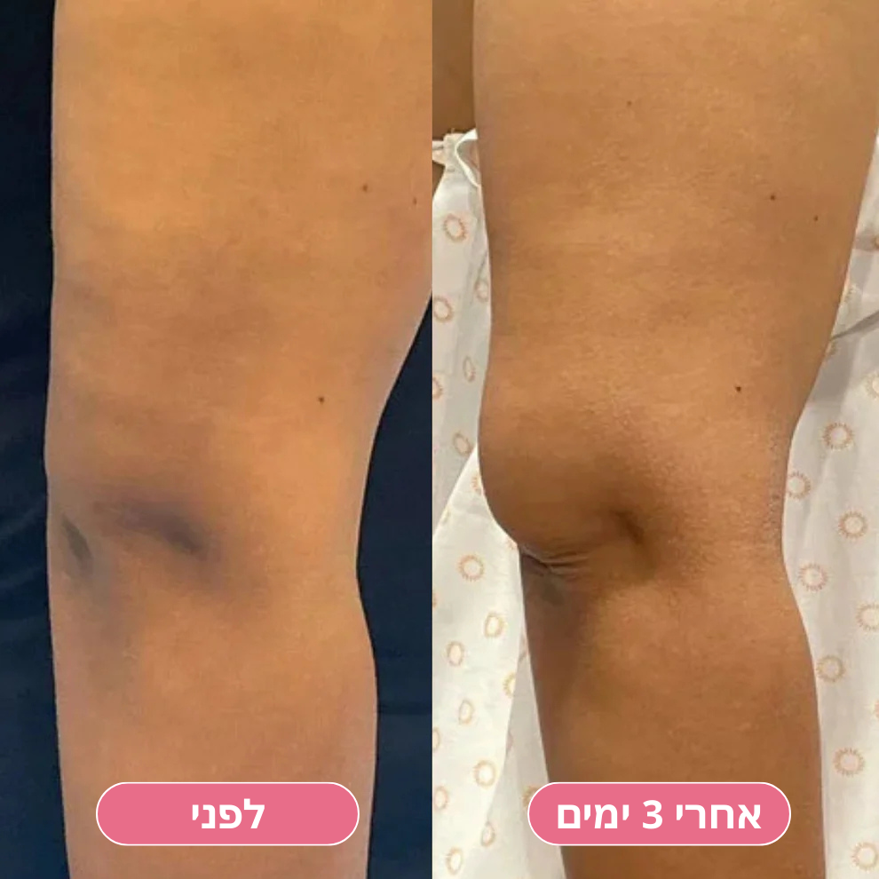 VelVet™ ספריי ניקוי חומצי מכורכום