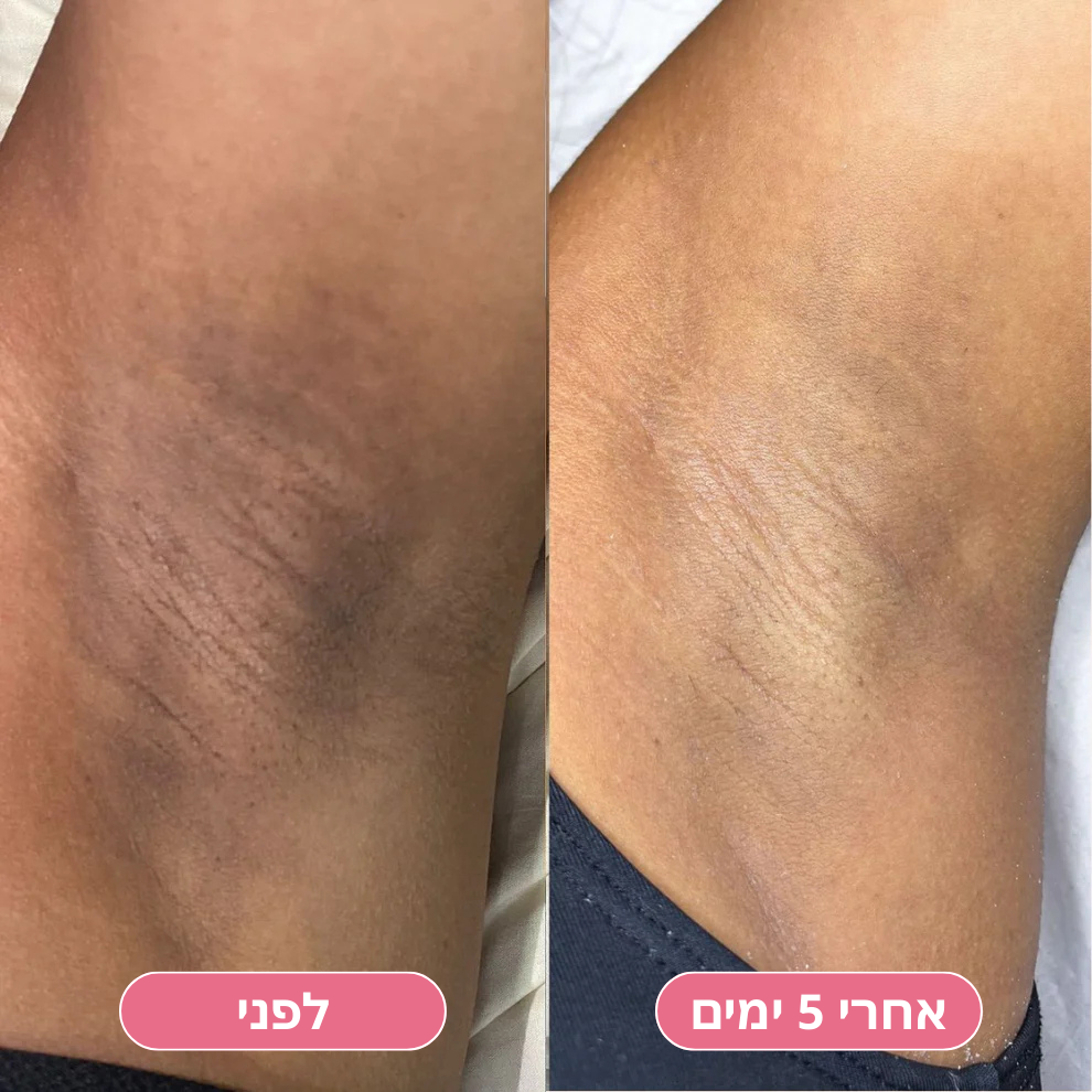 VelVet™ ספריי ניקוי חומצי מכורכום