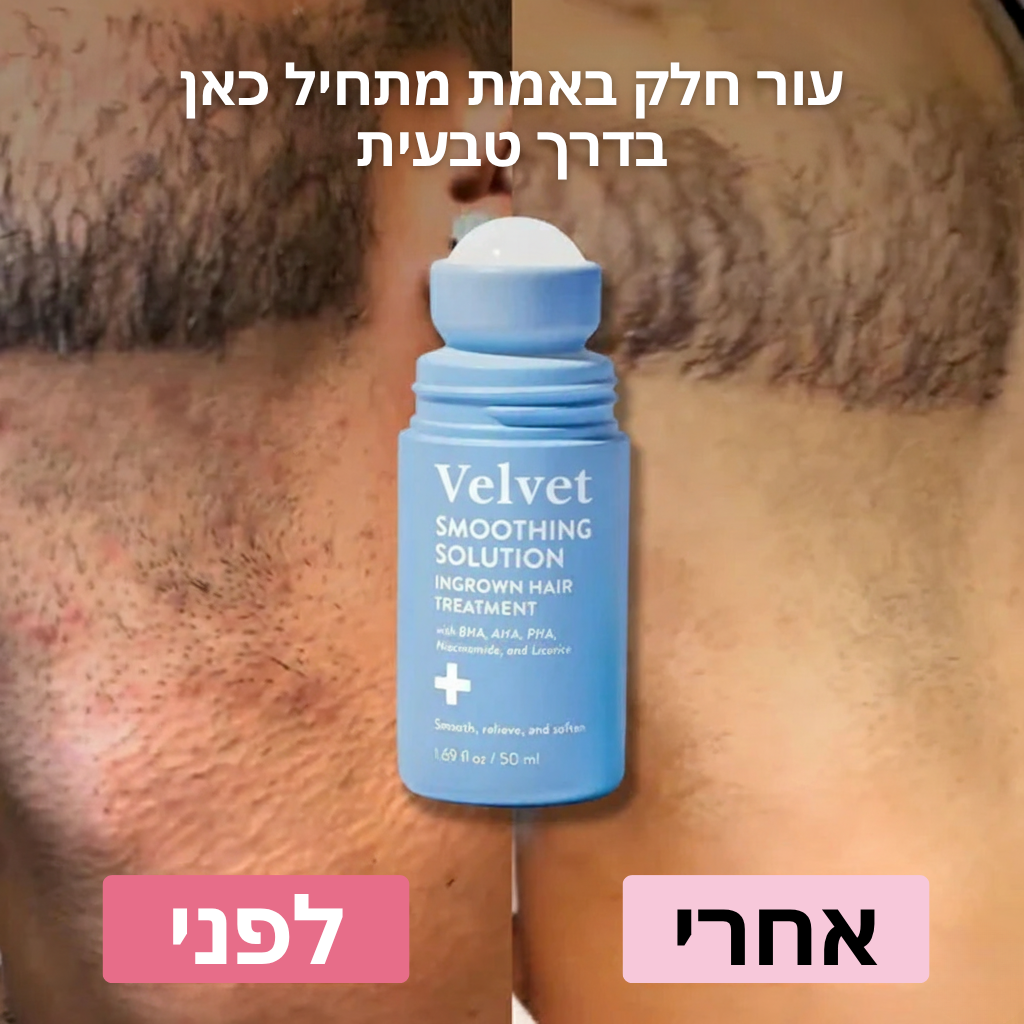 Velvet™ פתרון החלקה לטיפול בשערות חודרניות
