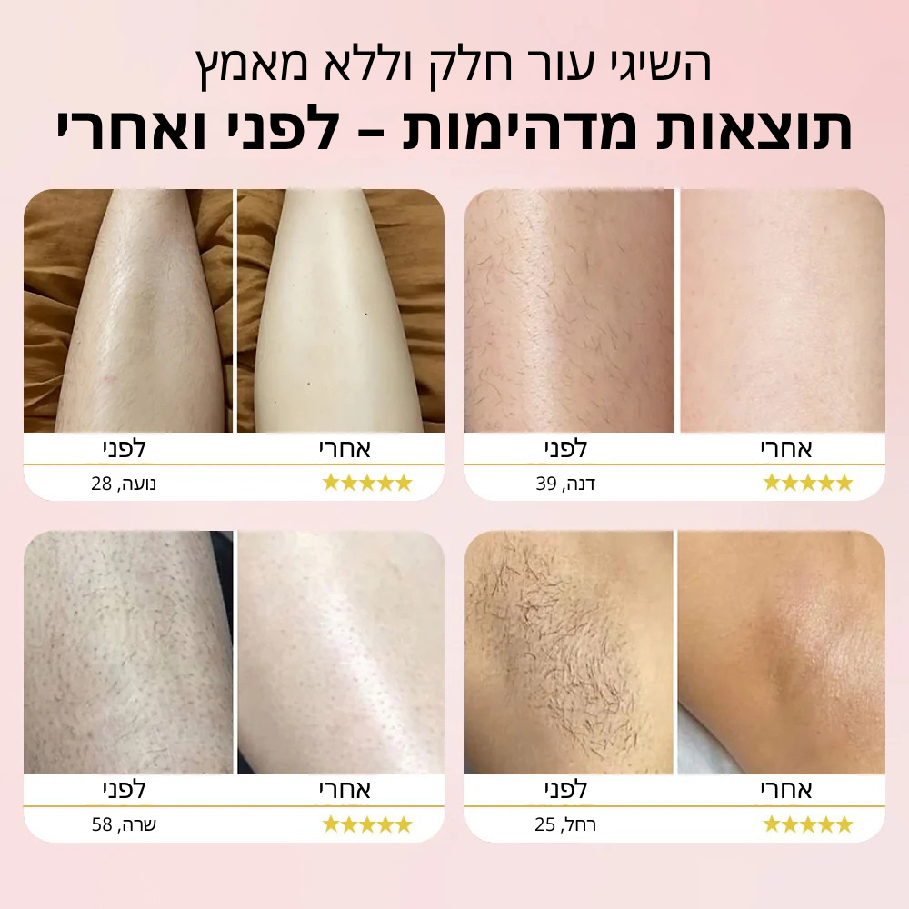 Velvet™ מכשיר גילוח נשי מהיר ונוח