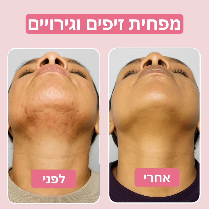 Velvet™ שמן טבעי להפחתת שיער לצמיתות