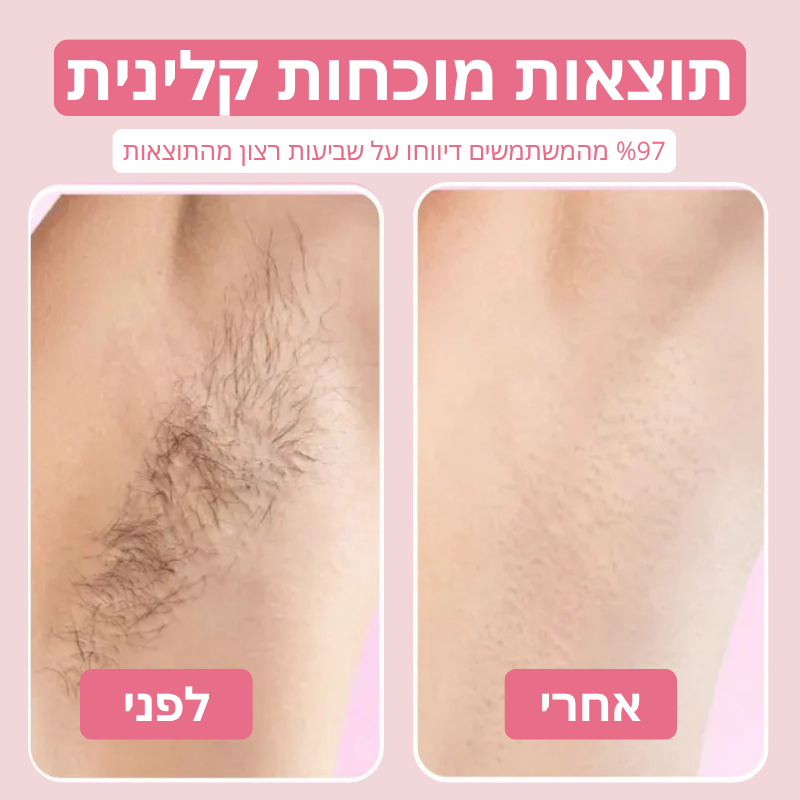 Velvet™ שמן טבעי להפחתת שיער לצמיתות