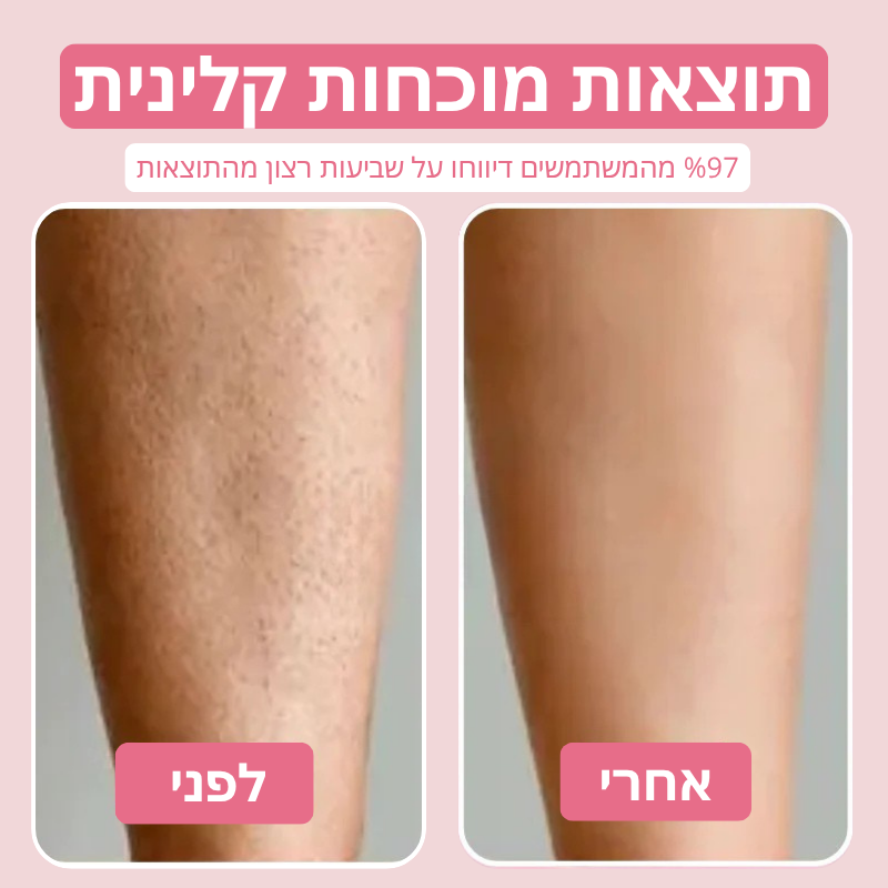 Velvet™ שמן טבעי להפחתת שיער לצמיתות